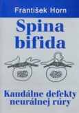 Spina bifida - Kaudálne defekty neuralnej rúry